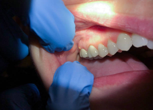 Best Pediatric Emergency Dentist in Mechanicsburg, OH